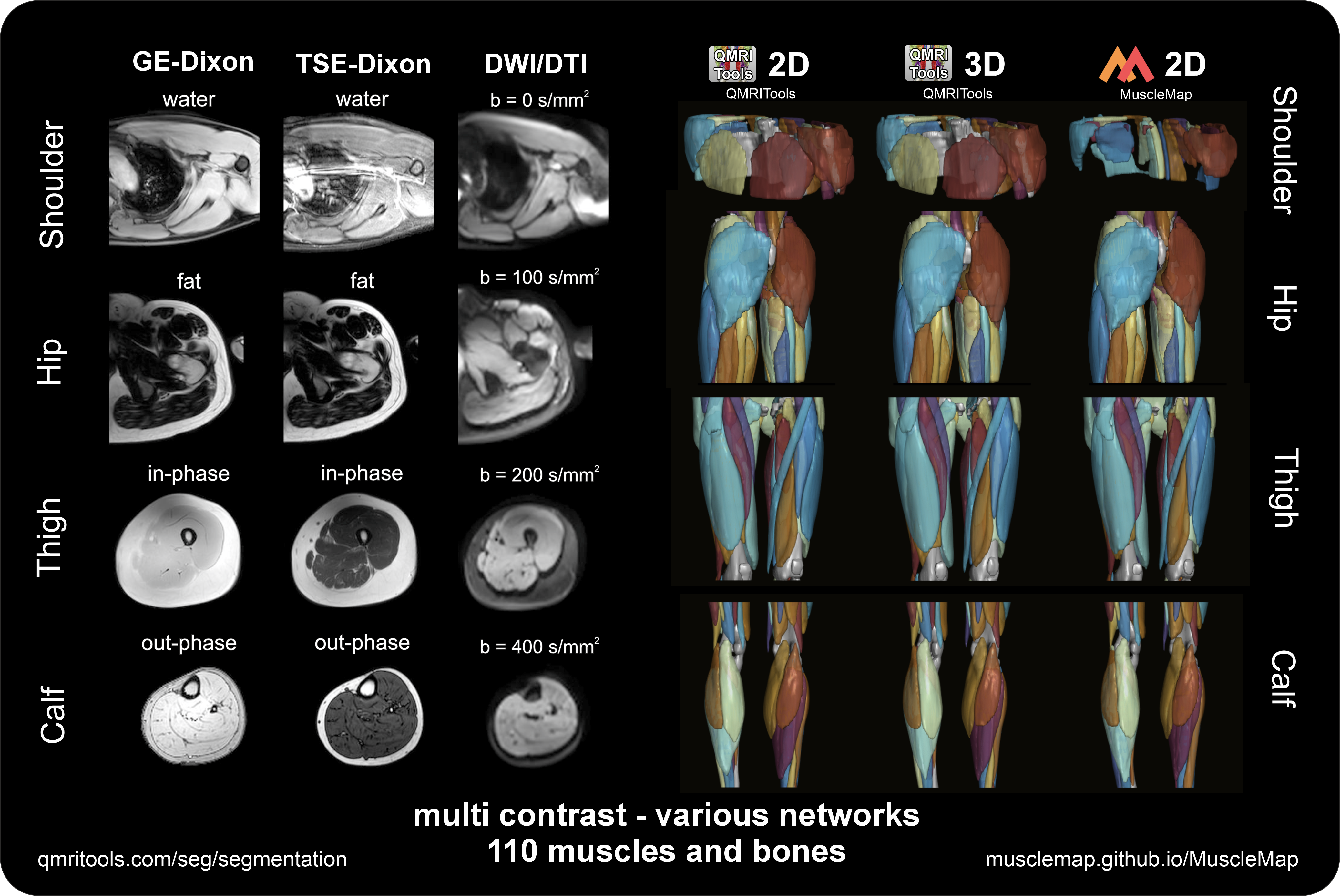 Automated muscle segmentation